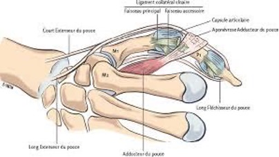 La réparation de l'entorse de l'articulation métacarpo ...